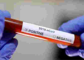 Covid-19 Cases in Kenya Surpass 8,000 as Death Toll Hits 164