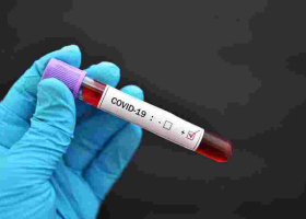 Gov’t Fears Hospitals May be Overwhelmed as Kenya Posts Highest Covid-19 Cases