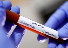 Kenya’s Daily Covid-19 New Cases Fall Below 100 as 83 Test Positive