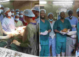 History as Kenyan Doctors Successfully Remove 13-Year-Old Stone Baby from Woman’s Abdomen 