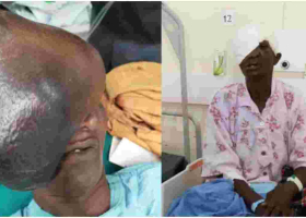Kenyan Doctors Remove 3kg Growth on Elderly Woman's Face, Ending 21 Years of Agony  