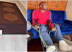 MPs Open a Probe After Electric Therapeutic Mat Burned Moses Kuria's Feet