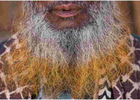 Lamu Muslim Leaders Decry Harassment of Bearded Men by Anti-Terror Police 