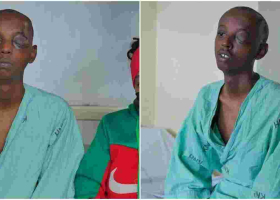 KNH Surgeons Save Teen with a Knife Lodged in the Eye 