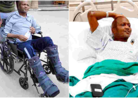 MP Moses Kuria Starts Walking Again After 4 Months in the Hospital, 10 Surgeries 