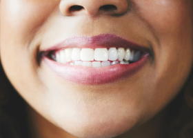 Why Adults Grind Their Teeth While Sleeping