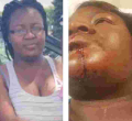 Kenyan Woman in Minnesota Nursing Serious Injuries after Attack by Husband at a Petrol Station