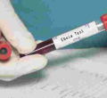 Kenyan Woman Quarantined After Showing Ebola-Like Symptoms Tests Negative for the Deadly Virus