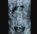 Thailand: Kenyan Woman Busted Carrying 1.2 Kilos of Cocaine in Her Stomach