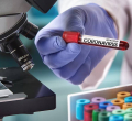 Government Says Reports of Coronavirus Case in Kenya are Fake