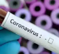 Second Coronavirus Case in Sub-Saharan Africa Confirmed in Senegal