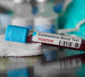 Ugandan Man, Daughter Arrested with Alleged Coronavirus ‘Vaccine’