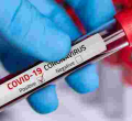 Uganda to Repatriate 27-Year-Old Kenyan Man Infected with Covid-19