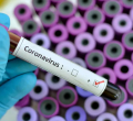 Six-Month-Old Baby Among 25 New Covid-19 Patients in Kenya