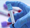 Kenyan Scientists to Conduct Trial for Three Possible Covid-19 Drugs 