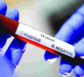 Kenya Records Highest Daily Covid-19 Recoveries as Cases Rise to 11,673