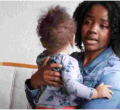 Kenyan Woman in Denmark Seeks Help to Raise $2 Million for Her 1-Year-Old Daughter's Treatment 