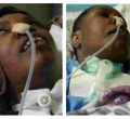 Family Appeals for Help as Kenyan Woman Remains in a Coma for Seven Years in Saudi Arabia