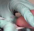 The First Cry Isn't Enough: Why Every Baby Should Be Screened at Birth