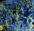 Africa CDC Reaffirms Support to Kenya Following Confirmation of Four Additional Ebola Cases