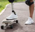 Innovative Prosthetics Testing Paves the Way for Global Medical Advancements