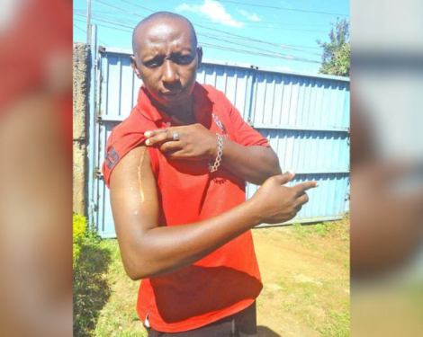 Kiambu Man Shot 13 Times Defies the Odds, Rebuilds Life After Deadly Attack