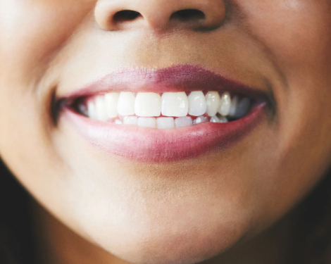 Why Adults Grind Their Teeth While Sleeping