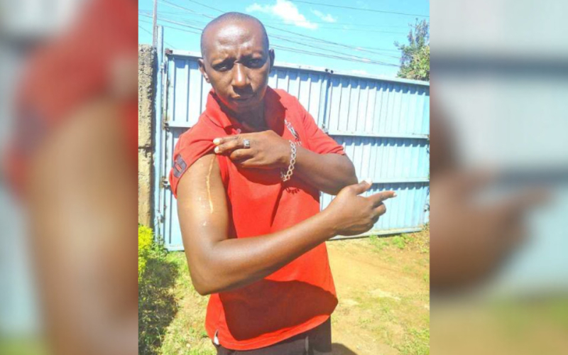 Kiambu Man Shot 13 Times Defies the Odds, Rebuilds Life After Deadly Attack