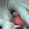 The First Cry Isn't Enough: Why Every Baby Should Be Screened at Birth