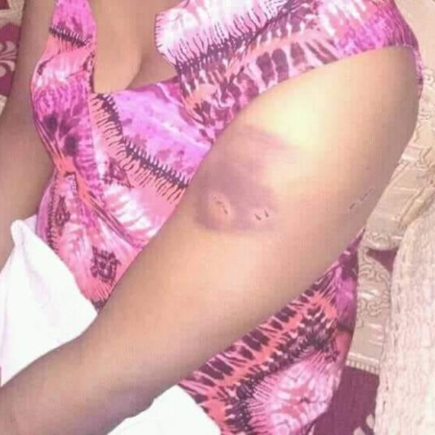 Githunguri MP Gabriel Kago Accused of Assaulting His Wife Using Hot Iron Box