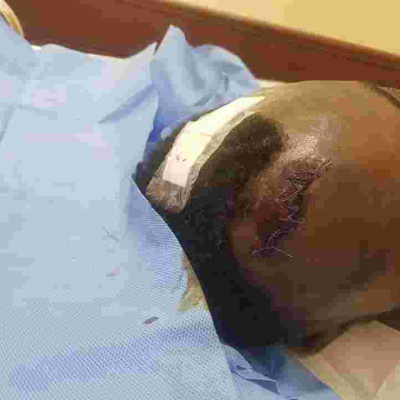 Senator Anwar Loitiptip Admitted to ICU After Attack by Armed Men at a Nairobi Club