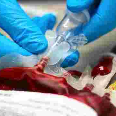 Kenyan Woman Attempts to Sell Her Blood to Raise School Fees for Daughter Who Scored 380 Marks 