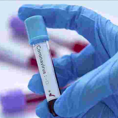 Kenyan Scientists to Conduct Trial for Three Possible Covid-19 Drugs 