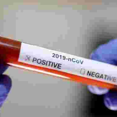 Covid-19 Cases in Kenya Surpass 8,000 as Death Toll Hits 164