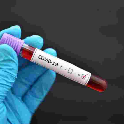 Gov’t Fears Hospitals May be Overwhelmed as Kenya Posts Highest Covid-19 Cases