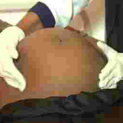 Withdrawal of US Pepfar Funding Exposes Pregnant Kenyan Women to Health Risks 