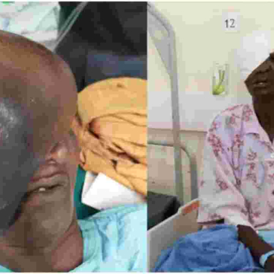 Kenyan Doctors Remove 3kg Growth on Elderly Woman's Face, Ending 21 Years of Agony  