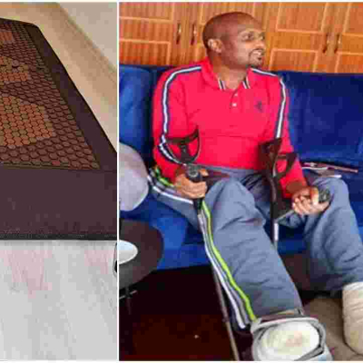 MPs Open a Probe After Electric Therapeutic Mat Burned Moses Kuria's Feet