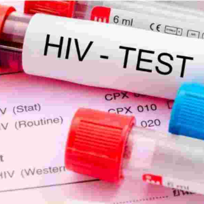 Concern as Nine Kenyan Counties Record Surge in HIV Cases