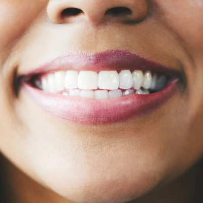 Why Adults Grind Their Teeth While Sleeping