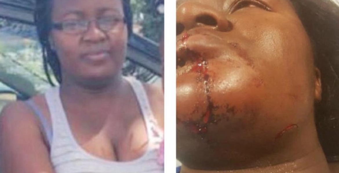 Kenyan Woman in Minnesota Nursing Serious Injuries after Attack by Husband at a Petrol Station