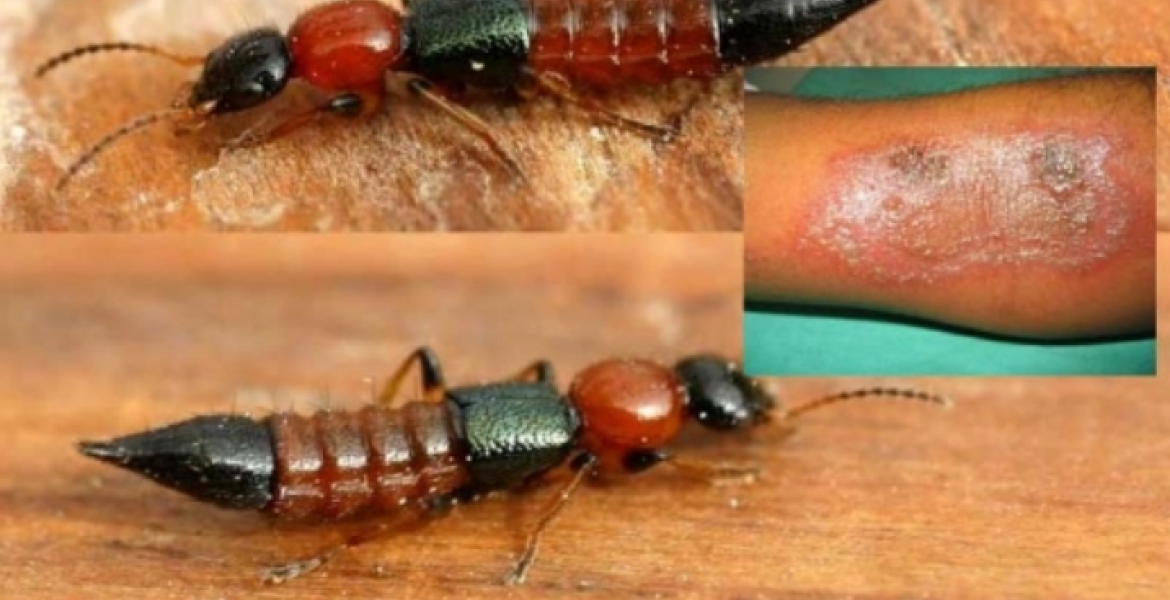 Kenyans Decry the Return of the Dreaded ‘Nairobi Fly’