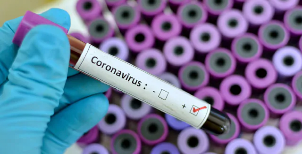 Nigeria Confirms Coronavirus Case, the First in Sub-Saharan Africa