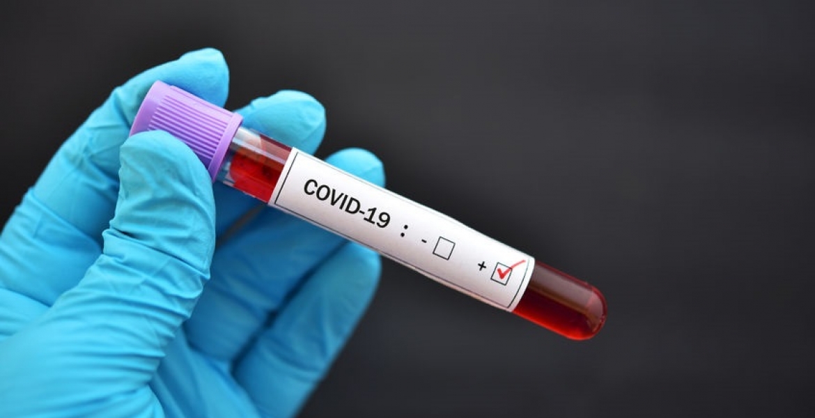 Gov’t Fears Hospitals May be Overwhelmed as Kenya Posts Highest Covid-19 Cases