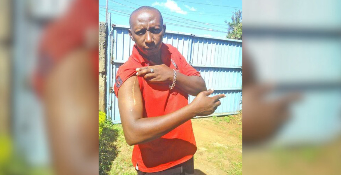 Charles Kamau Kiambu Man Shot 13 Times Defies the Odds, Rebuilds Life After Deadly Attack