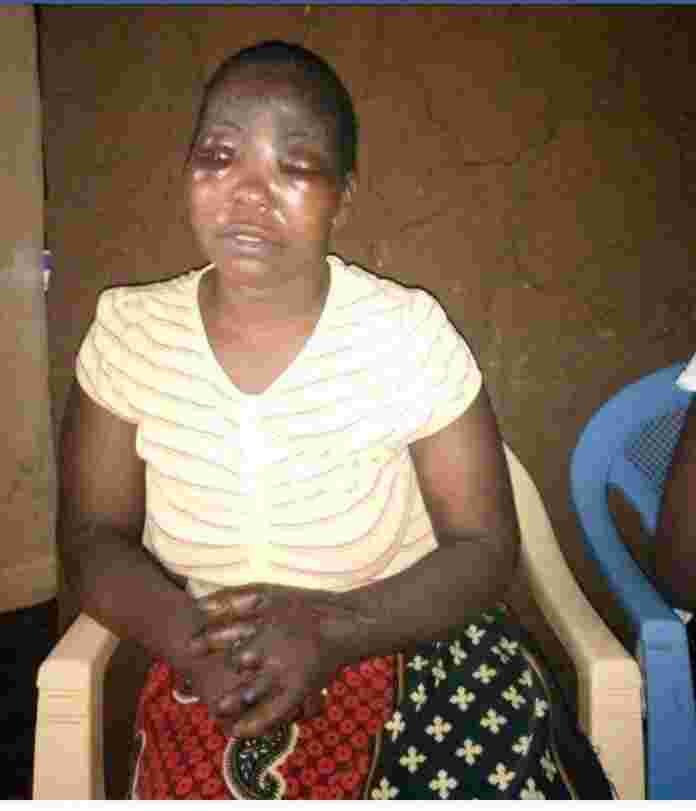 Kenyan Woman Loses Eye, Three Fingers in Another Case of Domestic Violence