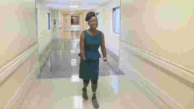 How Victoria Mugo, a Kenyan Woman in the US, Lost All Her Hands and Legs