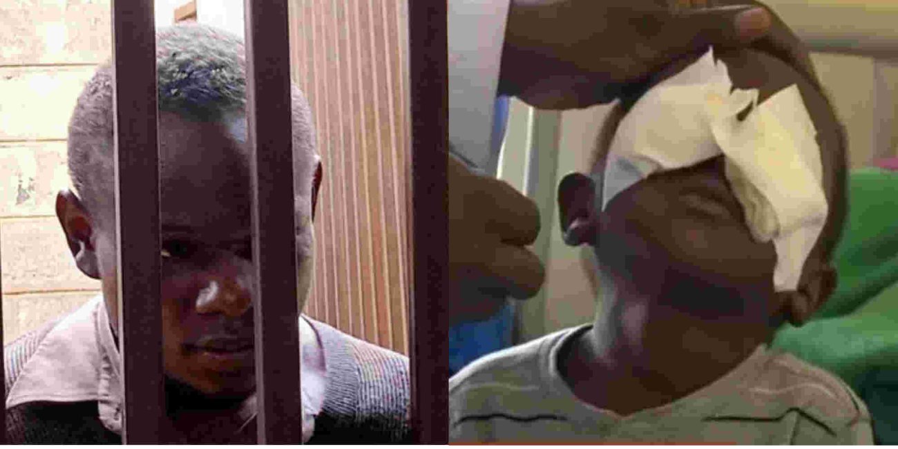 Main Suspect Arrested over Gouging Three-Year-old Boy’s Eyes in Kisii