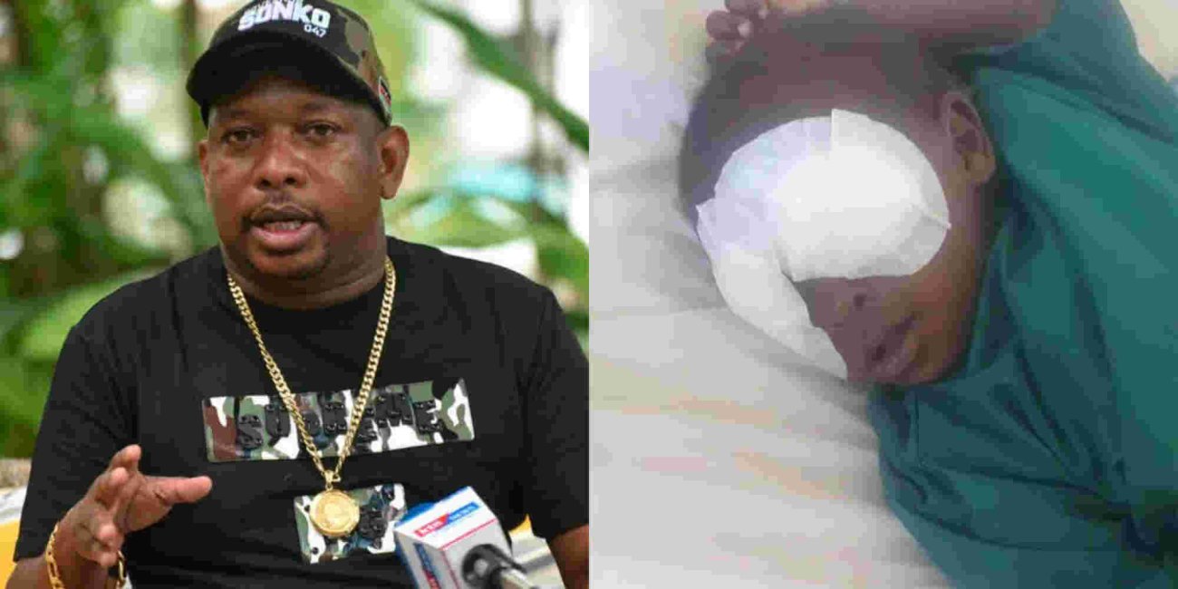 Sonko Offers to Fly Baby Sagini to South China for Eye Implants