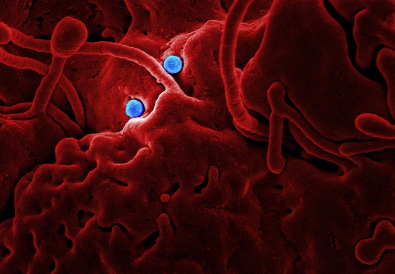 Ebola Outbreak Worsens as Scientists Rush to Test New Treatments